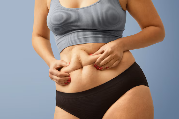 midlife belly fat